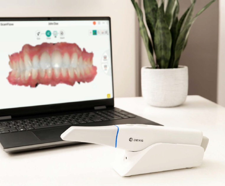 3D Scanner