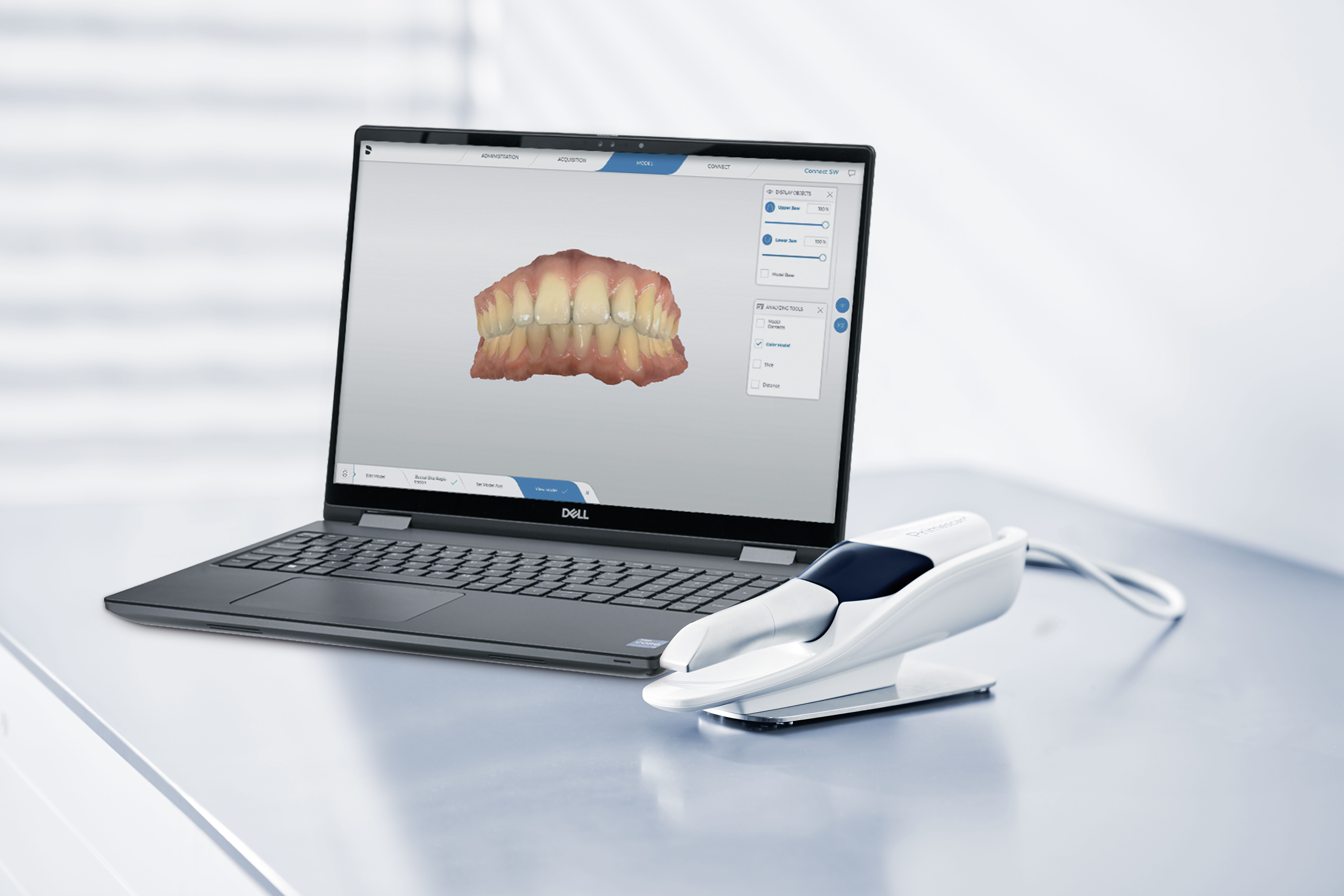 Laptop mit Intraoralscanner
