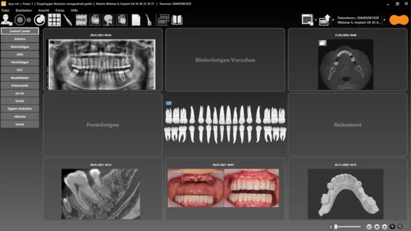 Bildschirm mit Scan von Mundraum